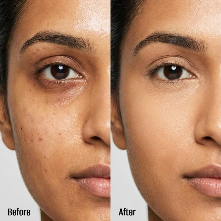 Forever52 Complete Covrage Concealer 10G
