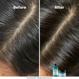 Loreal Scalp Advanced Anti Grass Oiliness Shampoo