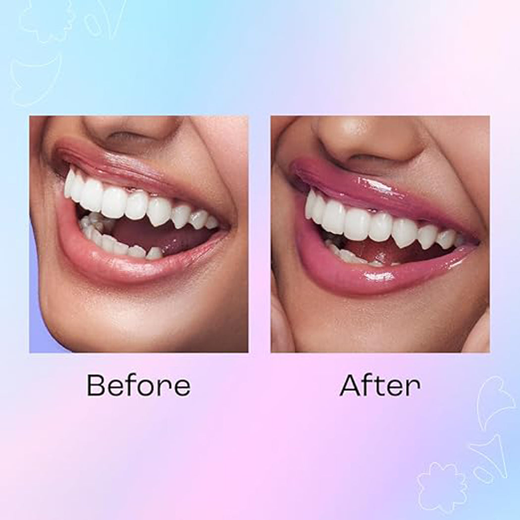 1377153