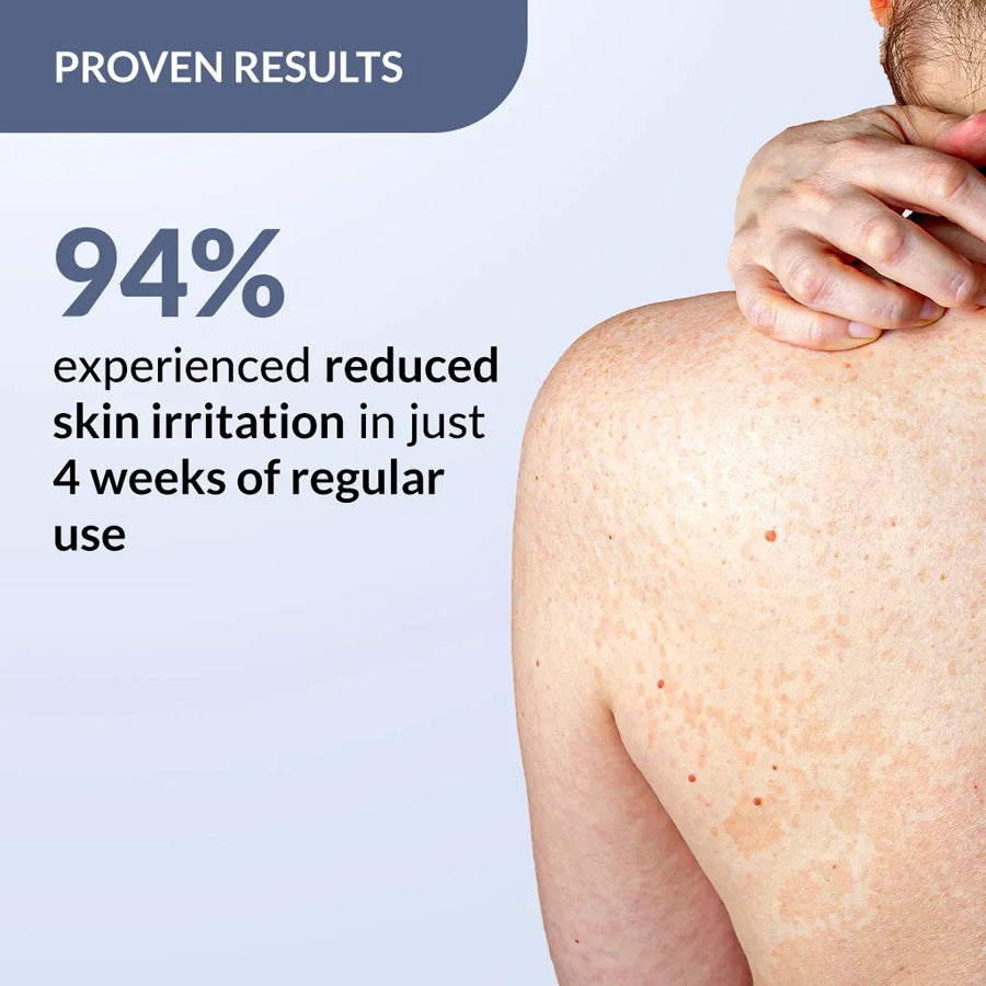 Fixderma Salyzap Spray For Body Acne