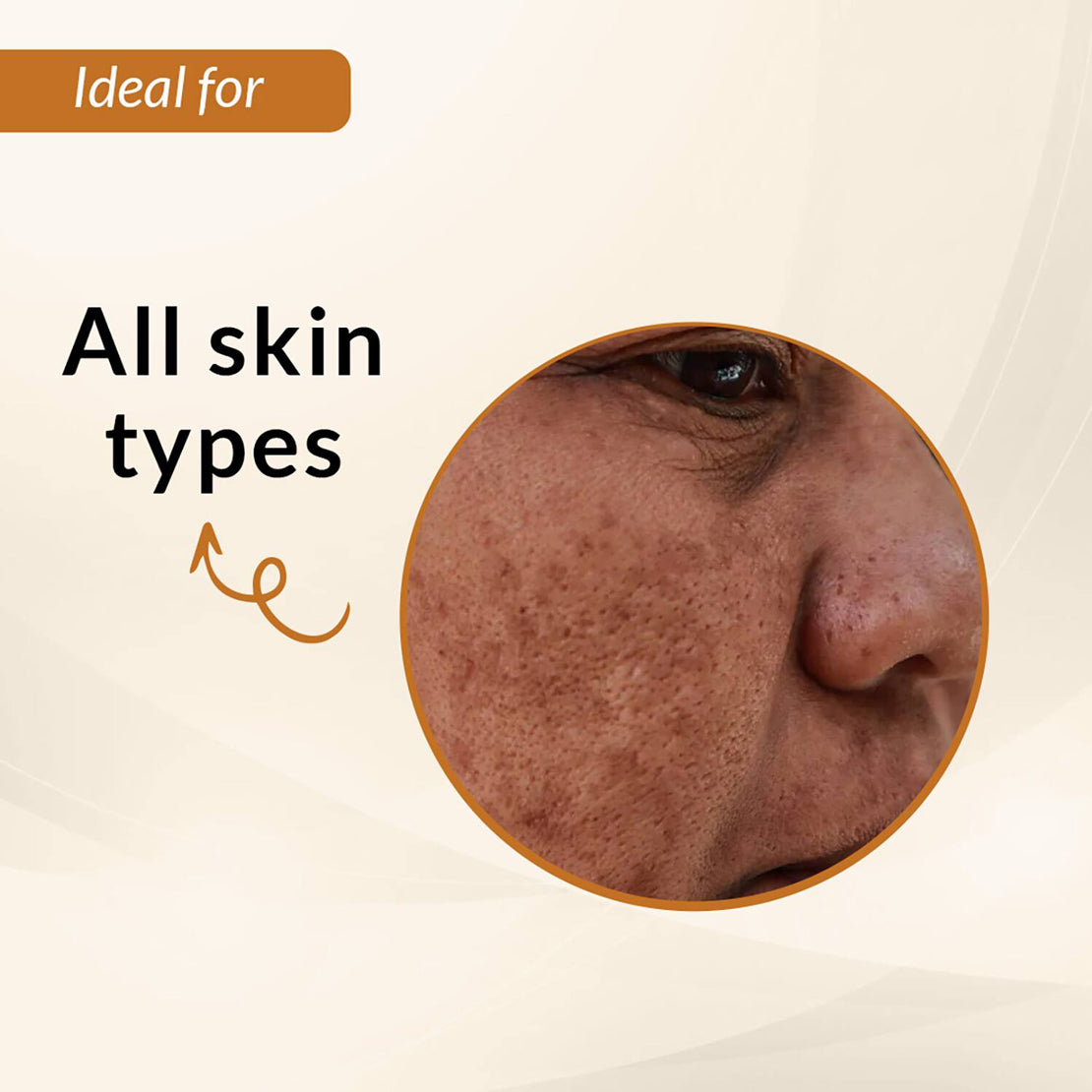 Fixderma Skarfix Plus Scar Removal Cream