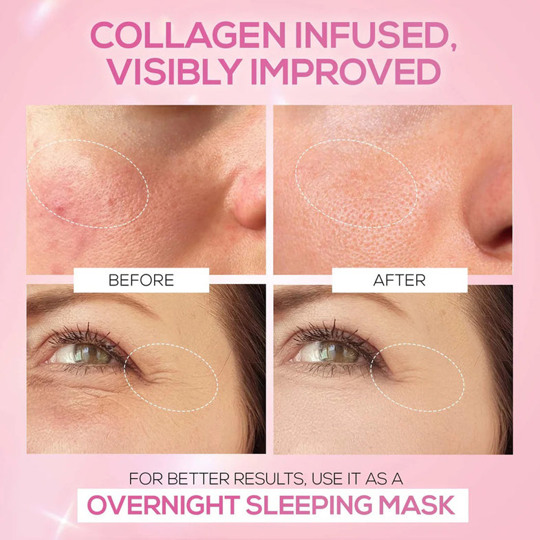 Renee Pink Therapy Hydrolyzed Collagen Jelly Cream 50G