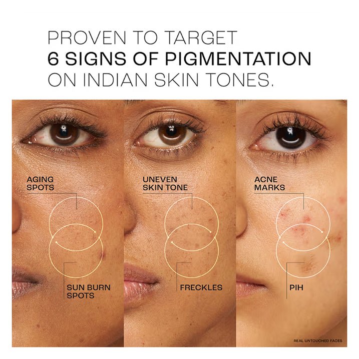 Lakme Perfect Radiance Pigmentation 10Per Treatment Day Gel Creme