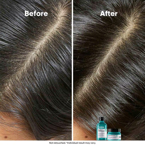 Loreal Scalp Advanced Anti Grass Oiliness Shampoo