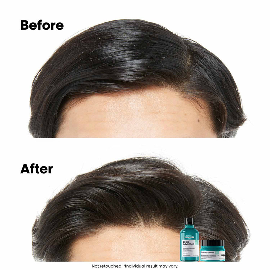 Loreal Scalp Advanced Anti Grass Oiliness Shampoo