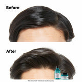 Loreal Scalp Advanced Anti Grass Oiliness Shampoo