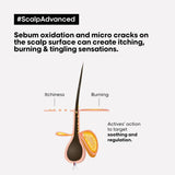 Loreal Scalp Advanced Anti-Inconfort Discomfort Shampoo