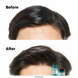 Loreal Scalp Advanced Anti-Grass Oiliness Professional Clay