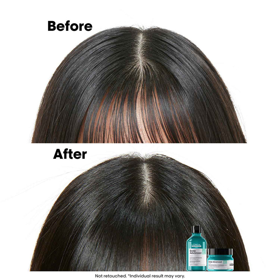 Loreal Scalp Advanced Anti-Grass Oiliness Professional Clay