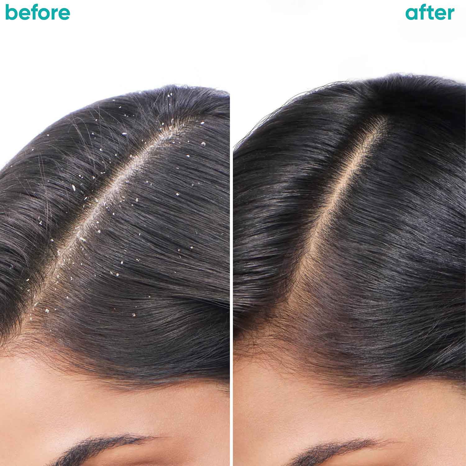 Matrix Biolage Scalppure Anti-Dandruff Conditioner