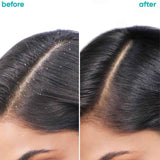 Matrix Biolage Scalppure Anti-Dandruff Conditioner