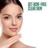 Natures Acne Magic Clear Skin Gel Face Wash 65Ml