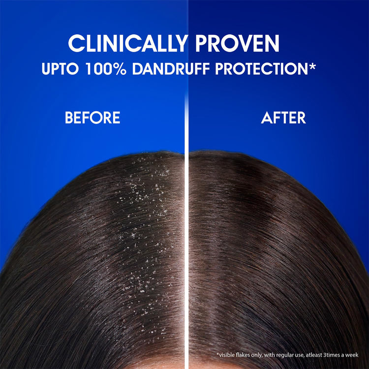 Head & Shoulders Anti-Dandruff & Anti-Hairfall Fall Shampoo