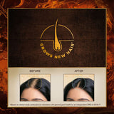 Indulekha Bringha Ayurvedic Hair Oil