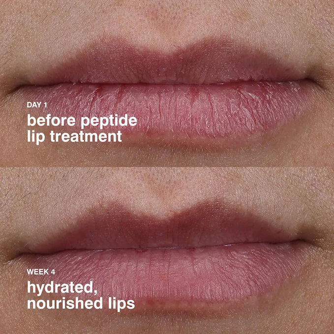Rhode Peptide Lip Treatment 10Ml