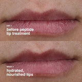 Rhode Peptide Lip Treatment 10Ml