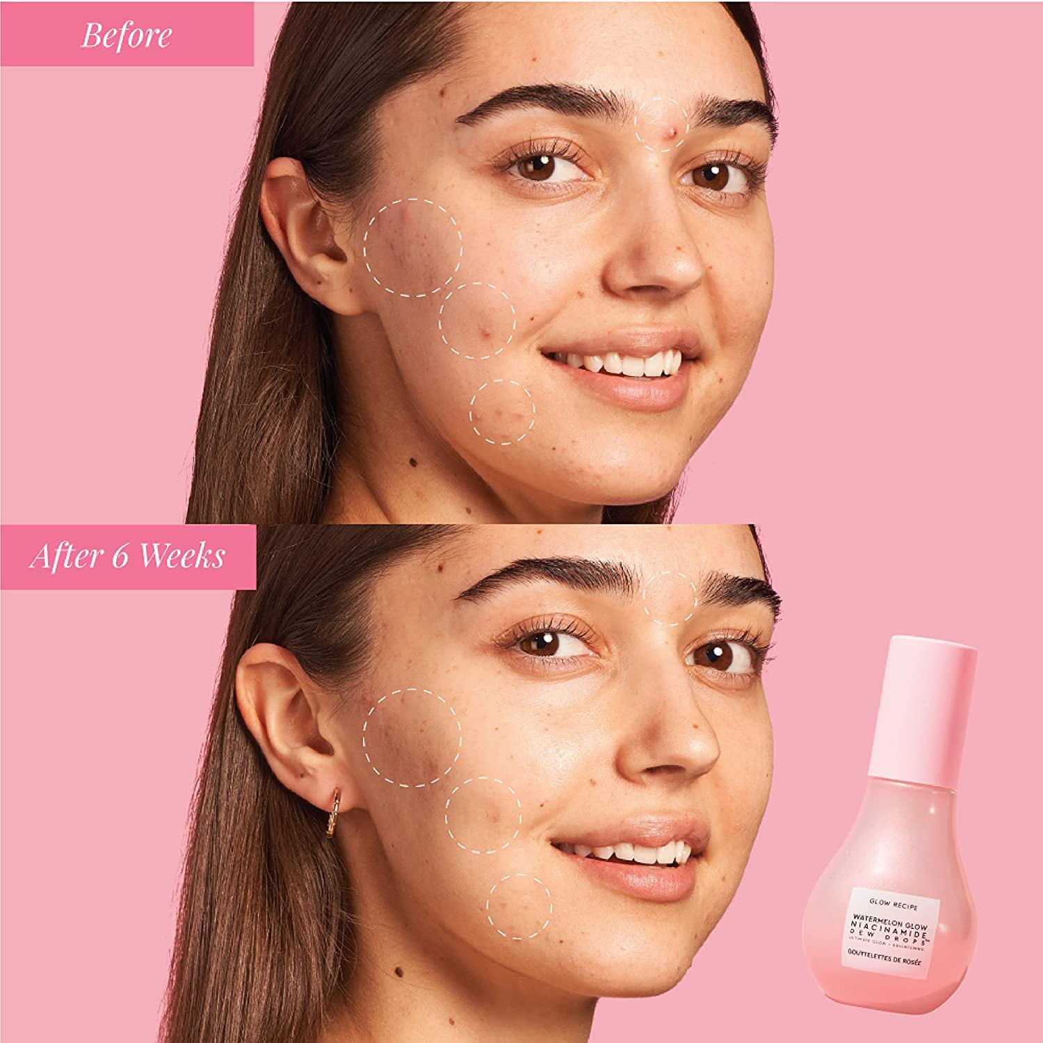Glow Recipe Watermelon Niacinamide Dew Drops