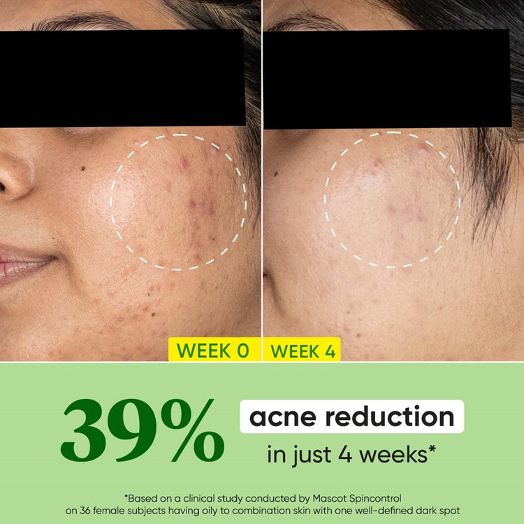Dot & Key Cica & Niacinamide Night Gel For Oily & Acne Prone Skin