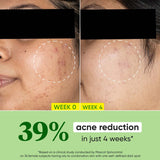 Dot & Key Cica & Niacinamide Night Gel For Oily & Acne Prone Skin