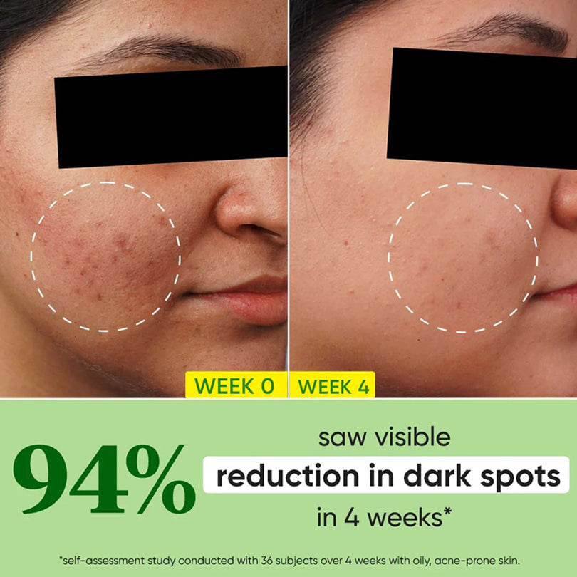 Dot & Key Cica + 10Per Niacinamide Spot Reduction Face Serum