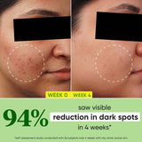 Dot & Key Cica + 10Per Niacinamide Spot Reduction Face Serum