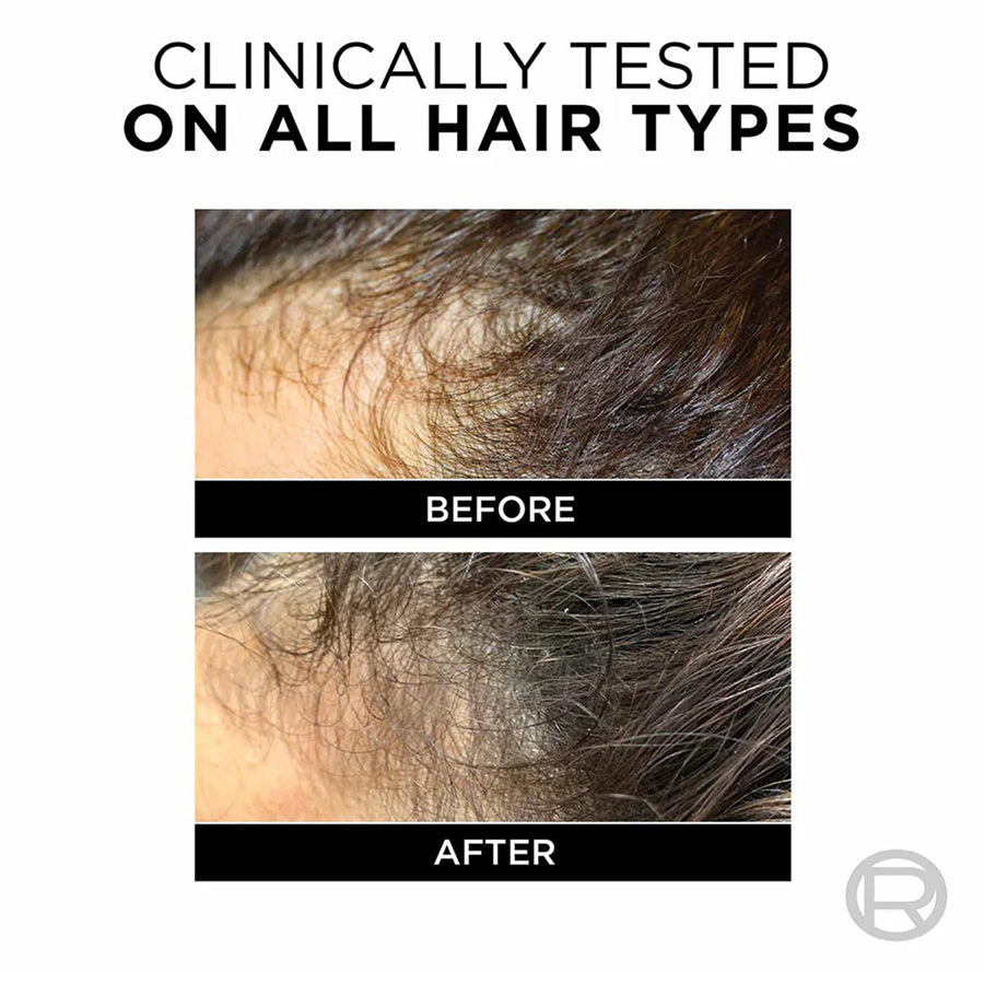 Loreal Fall Resist 3X Conditioner Anti Haifall