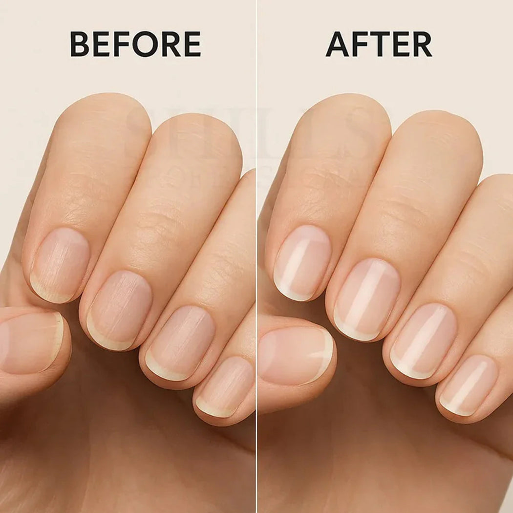 Shills Nail Therapy 12 In 1 Growth & Repair 15Ml
