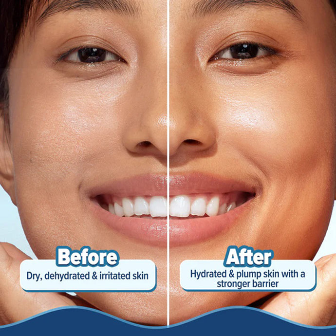 Aqualogica 5 Barrier+ Hydra Gel Moisturiser Avacado & 5 Essential Ceramides