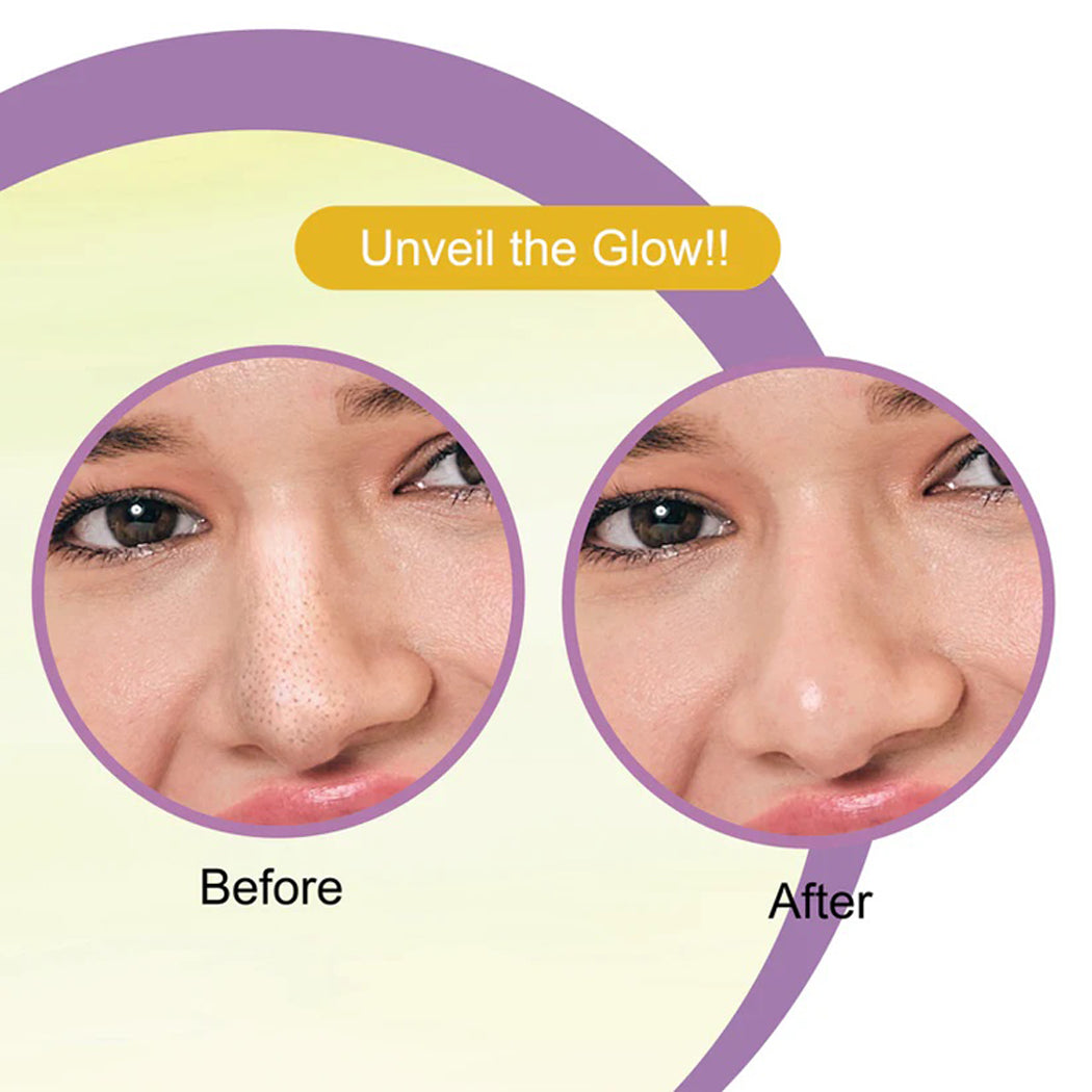 Dr Rashel De-Tan Nose Pore Strips