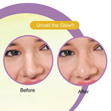 Dr Rashel De-Tan Nose Pore Strips