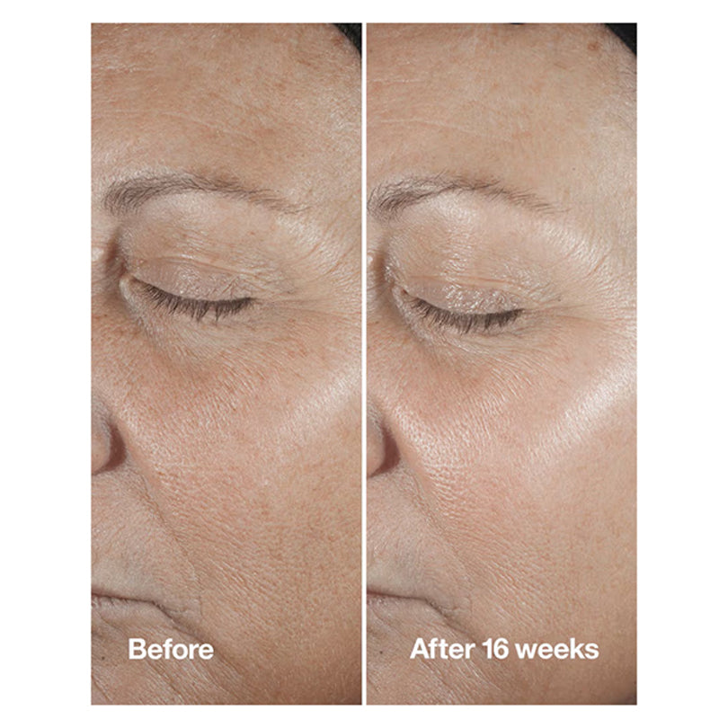 Clinique Smart Clinical Repair Wrinkle Correcting Serum With Retinoid