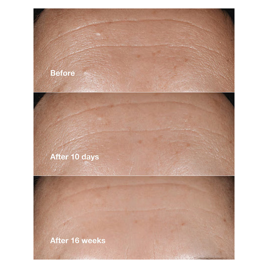 Clinique Smart Clinical Repair Wrinkle Correcting Serum With Retinoid