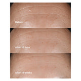 Clinique Smart Clinical Repair Wrinkle Correcting Serum With Retinoid