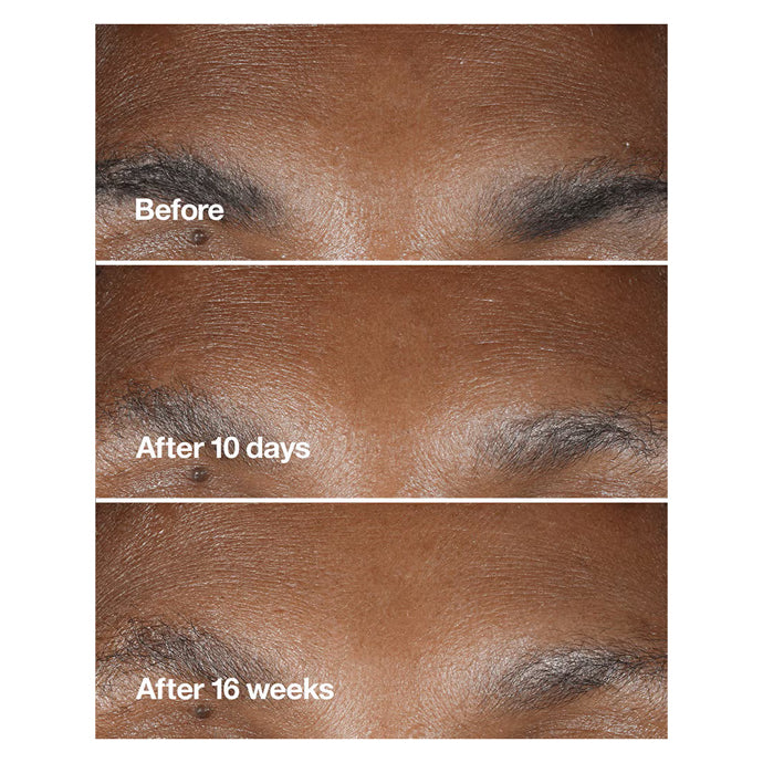 Clinique Smart Clinical Repair Wrinkle Correcting Serum With Retinoid