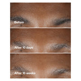 Clinique Smart Clinical Repair Wrinkle Correcting Serum With Retinoid
