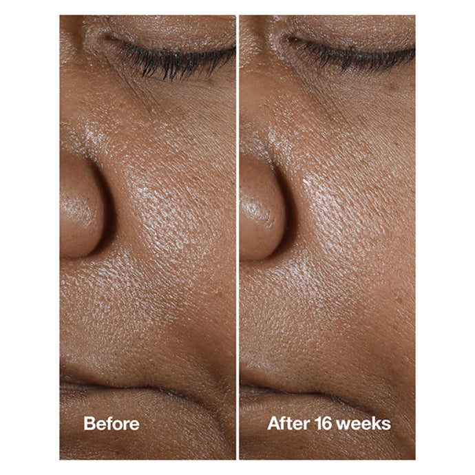 Clinique Smart Clinical Repair Wrinkle Correcting Serum With Retinoid