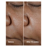 Clinique Smart Clinical Repair Wrinkle Correcting Serum With Retinoid