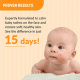 Fixderma Hoopoe Anti Rash Face Cream