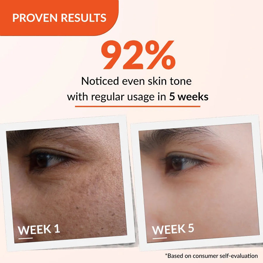 Fixderma Skarfix-Tx Cream