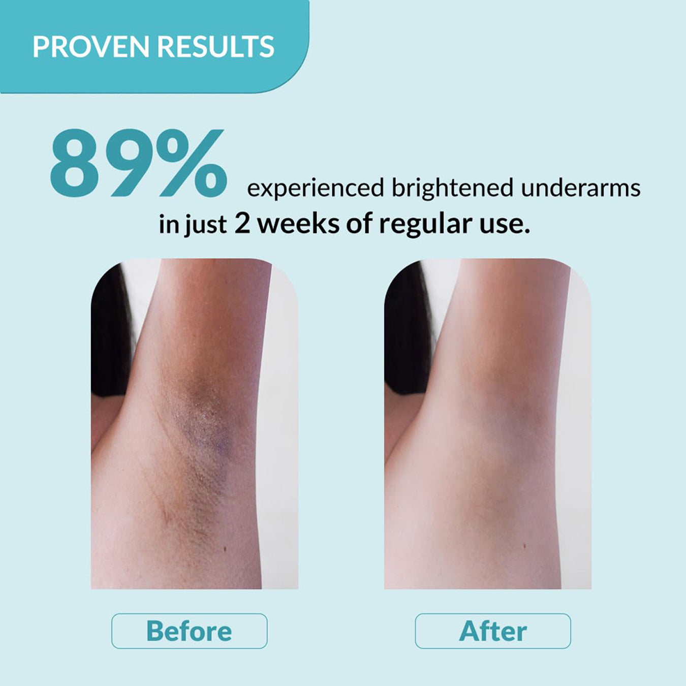 Fixderma Nigrifix Underarm Lightening Roll On