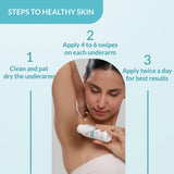 Fixderma Nigrifix Underarm Lightening Roll On