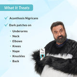 Fixderma Nigrifix Cream