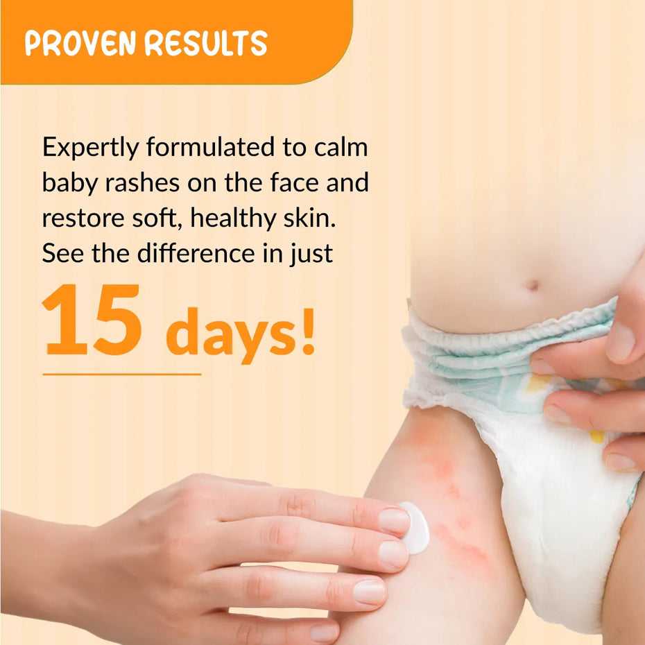 Fixderma Hoopoe Diaper Rash Cream