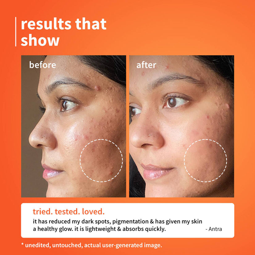Plum 10Per Vitamin C Barrier Boosting + Glow Serum