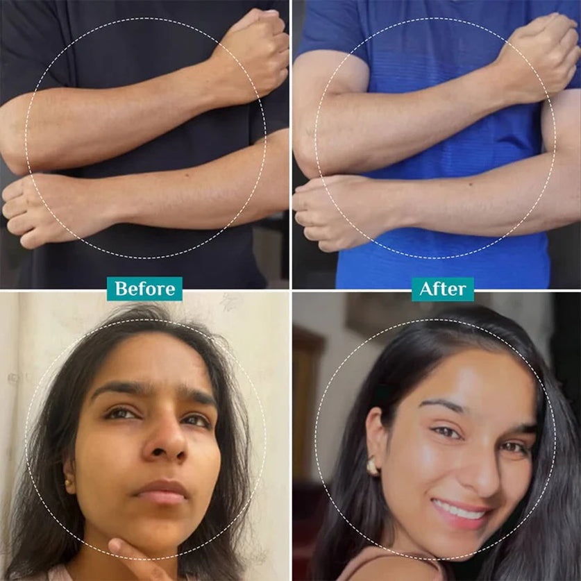 Pilgrim 25 Per Aha 2 Per Bha 5 Per Pha Peeling Solution