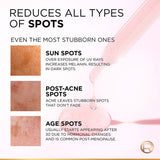 Loreal Glycolic Day Cream + Night Cream+Serum 50+50+30ML