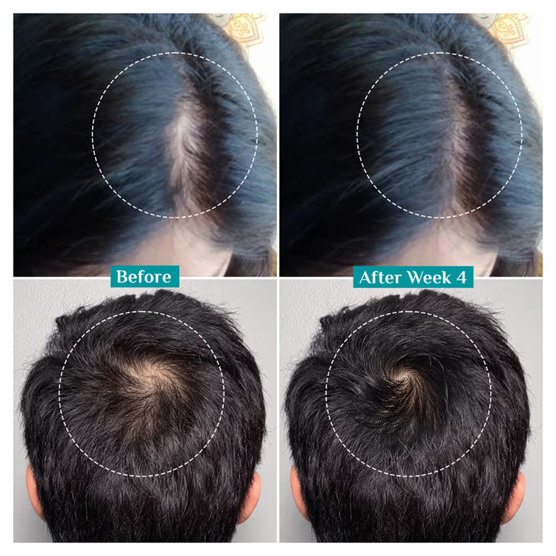 Pilgrim Advanced Hair Growth Serum
