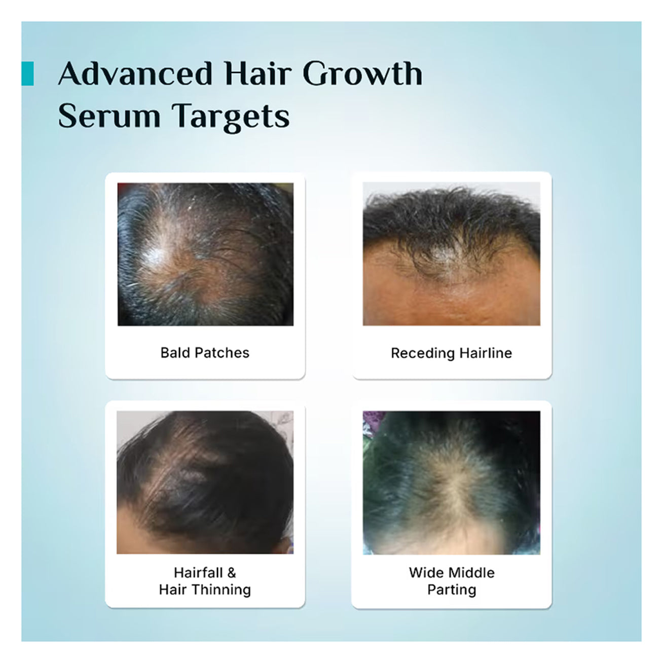 Pilgrim Advanced Hair Growth Serum