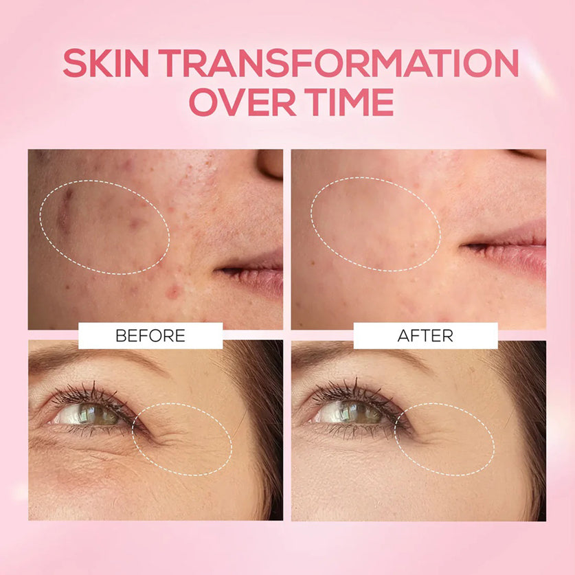 Renee Pink Therapy PDRN Pink Peptide Serum 30ML