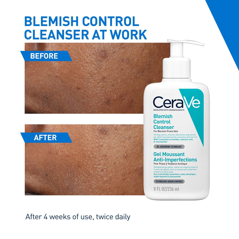 Cerave Blemish Control Cleanser